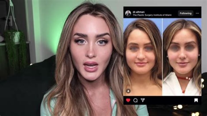 Alyssa Mckay Plastic Surgery Viral On Tiktok: Before And After Photo