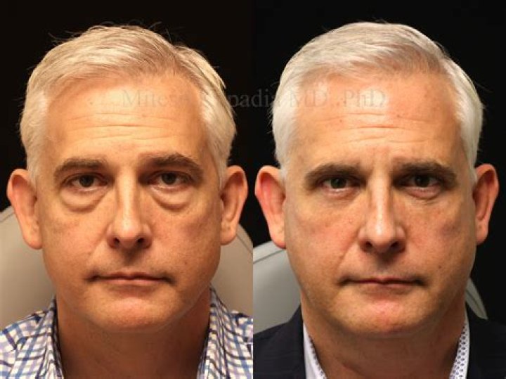 Did Gabimfmoura Get A Plastic Surgery? Here Are Before And After Pictures