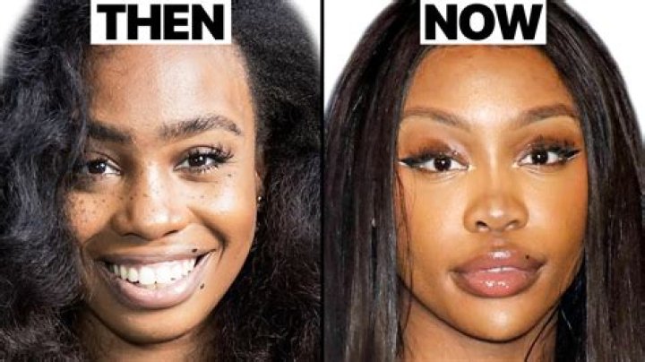 
Did Sarah Jayne Dunn Get Her Lips Done? Plastic Surgery Before And After 