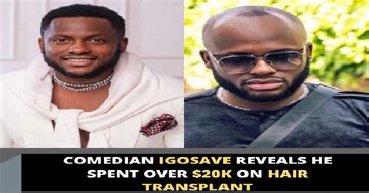 
I Go Save Shows Off Transformation Following $20k Hair Transplant 