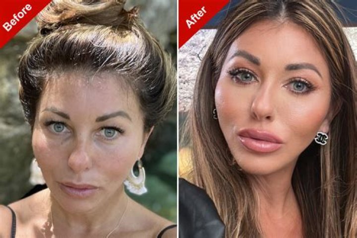 
Kim Lee Before And After Plastic Surgery, Who Is Kim Lee? 