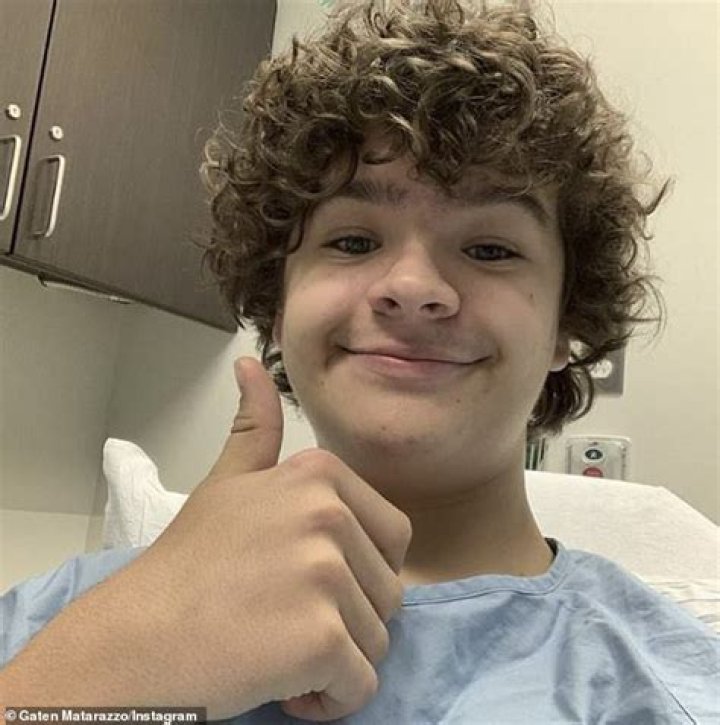 What Is Wrong With Gaten Matarazzo Teeth? More On Cleidocranial Dysplasia Surgery
